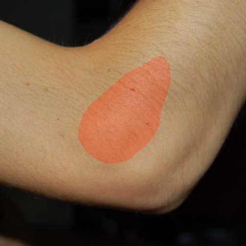 Area of pain in tennis elbow shown in red over that outside of an elbow