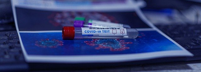 coronavirus-covid-19-test tube